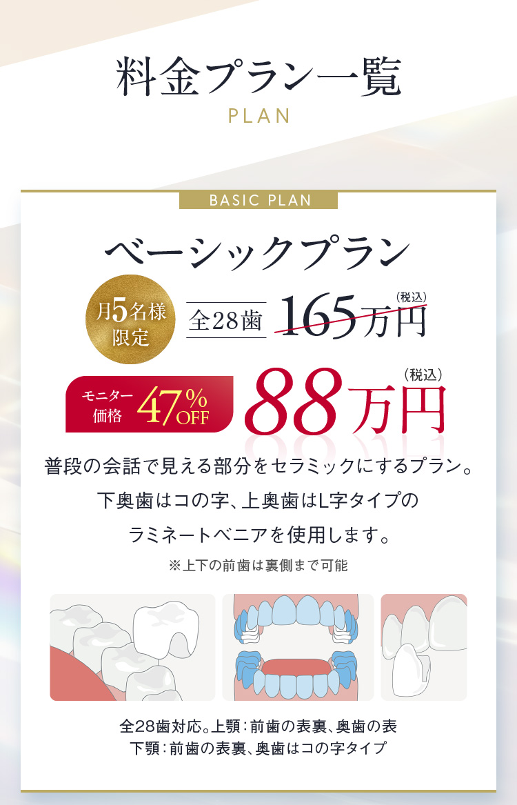 料金プラン一覧 ベーシックプラン 月5名様限定 全28歯 モニター価格 47%OFF 88万円（税込）